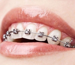 11130261_816518631765314_7598791285406775436_n